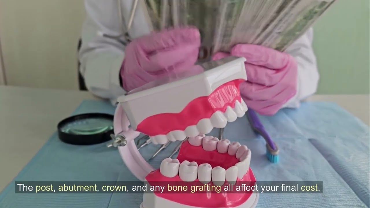 How Much Do Affordable Dental Implants Cost in Vista?