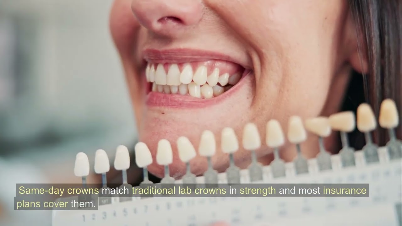 Can You Get a Same-Day Crown or Same-Day Smile in Vista?