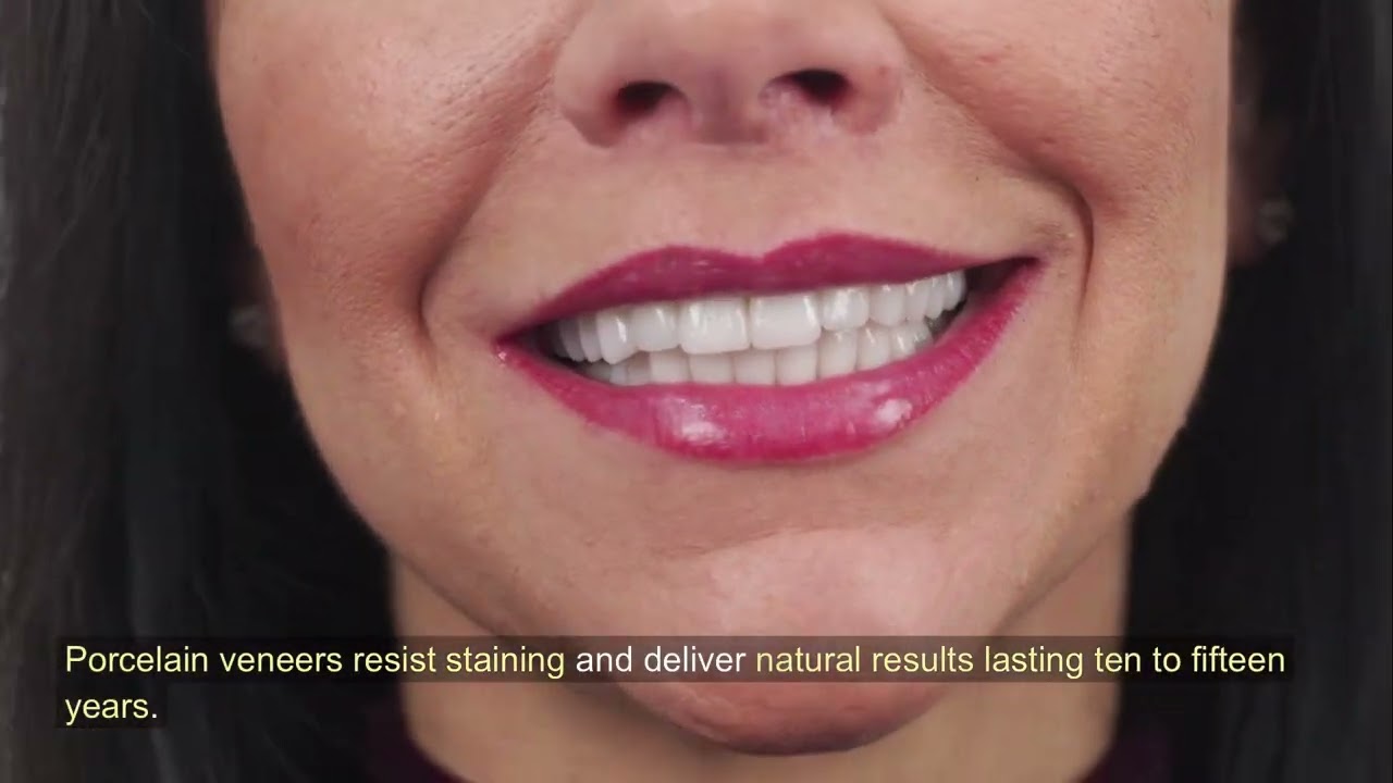 Porcelain Veneers vs Composite: Which Is Right for Your Smile?