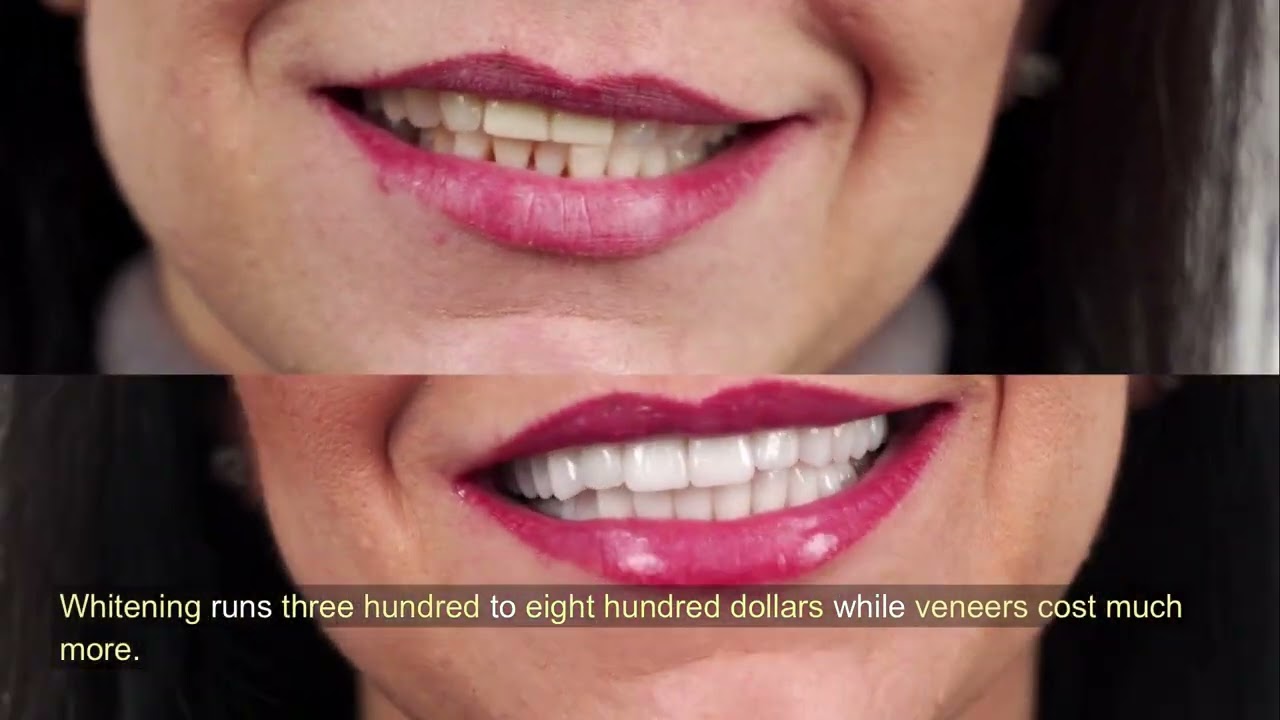 How much do cosmetic dental treatments typically cost in the US?
