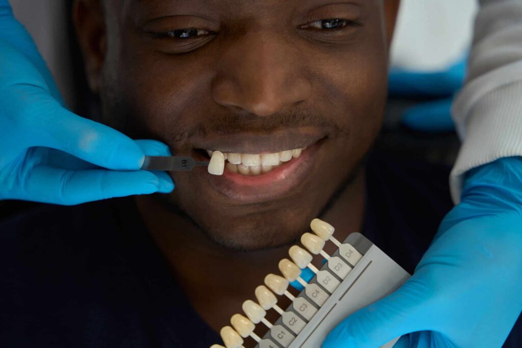 Dental Veneers Bonsall, CA