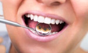 Dentist San Marcos, CA