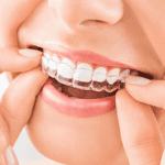 Invisalign Oceanside, CA